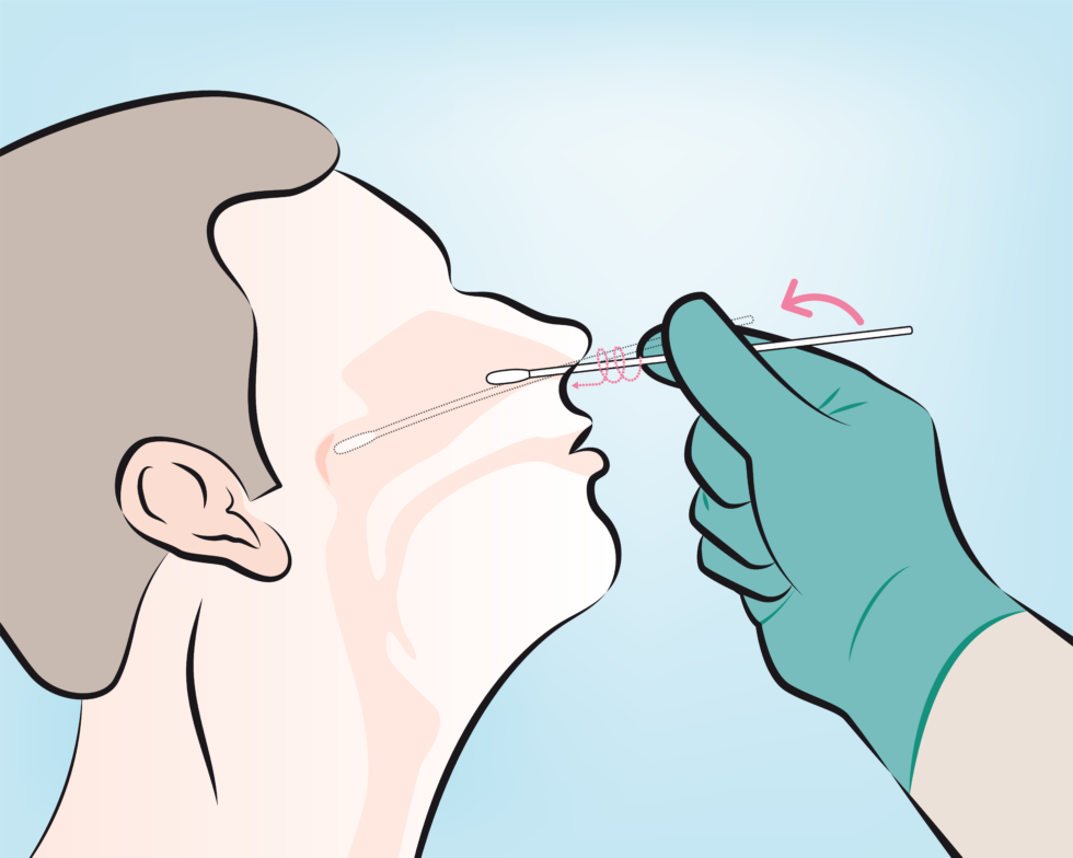 covid-19-testing-swabs-cna-scientific